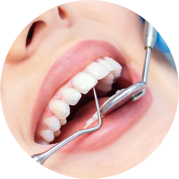 Dental Services Dental_Services