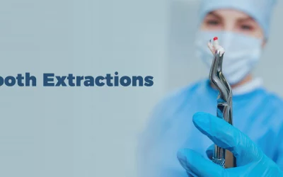 TOOTH EXTRACTIONS