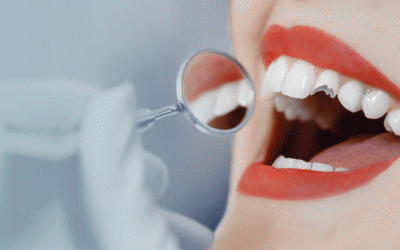 كسر أو خلع الأسنان